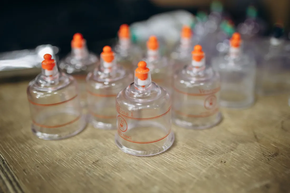 Close-up of silicone cupping therapy cups used for muscle recovery